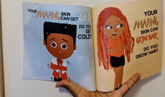 My Amazing Skin Can Heal: A Book About Boo-Boos, Bandages and Band Aids (Human Body For Kids)