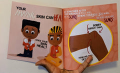 My Amazing Skin Can Heal: A Book About Boo-Boos, Bandages and Band Aids (Human Body For Kids)