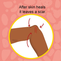 Human Body Homeschool Skin: I Can Read Books Level 1 (I Can Read Kids Books Book 9)